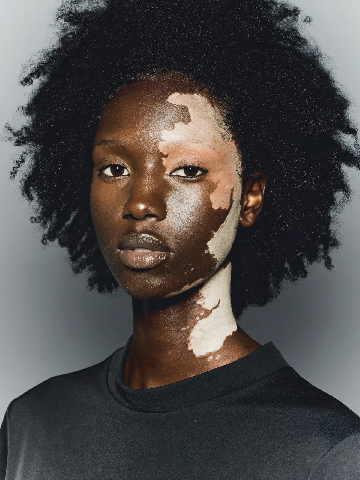Naima, AI-generated model for the editorial: vitiligo, natural afro